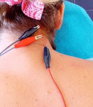 Acupuntura electrica